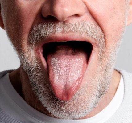 Symptome wenn Candida abstirbt