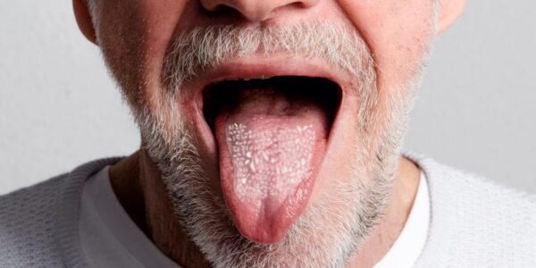 Symptome wenn Candida abstirbt